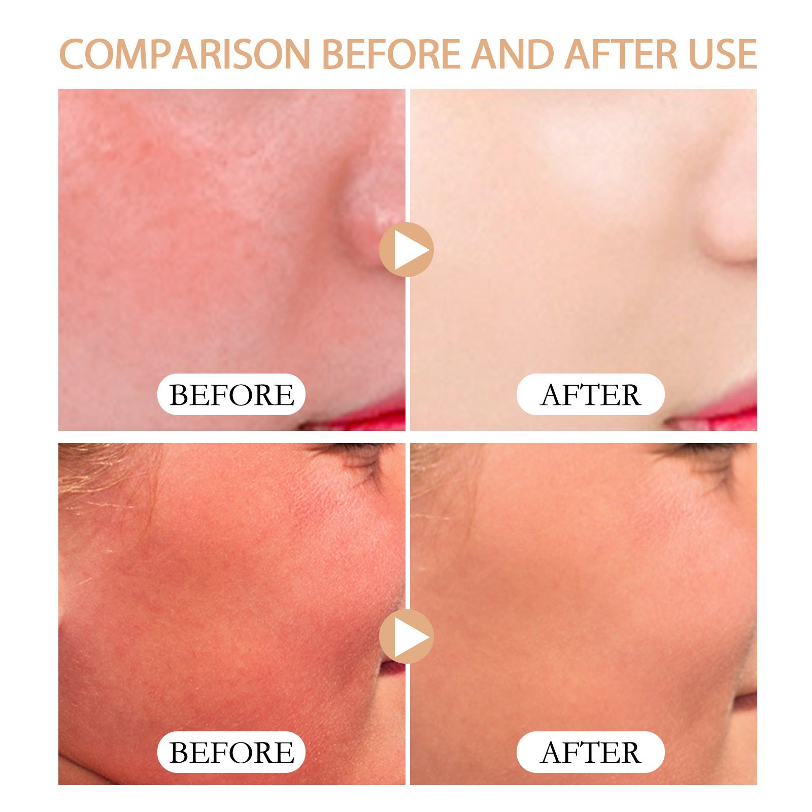 Refreshing UV Protection Cream – Lightweight & Non-Oily