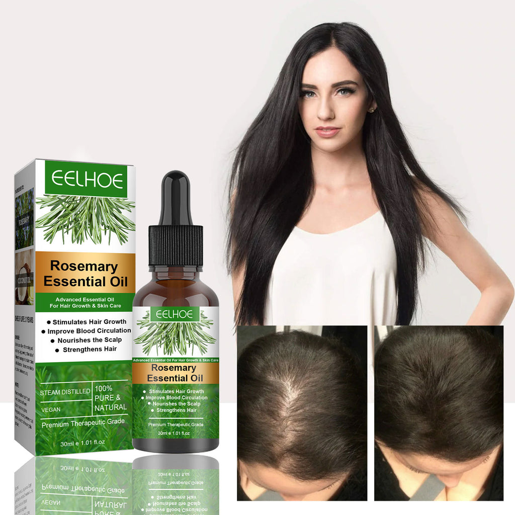 Rosemary Hair Oil – Anti-Breakage & Nourishing