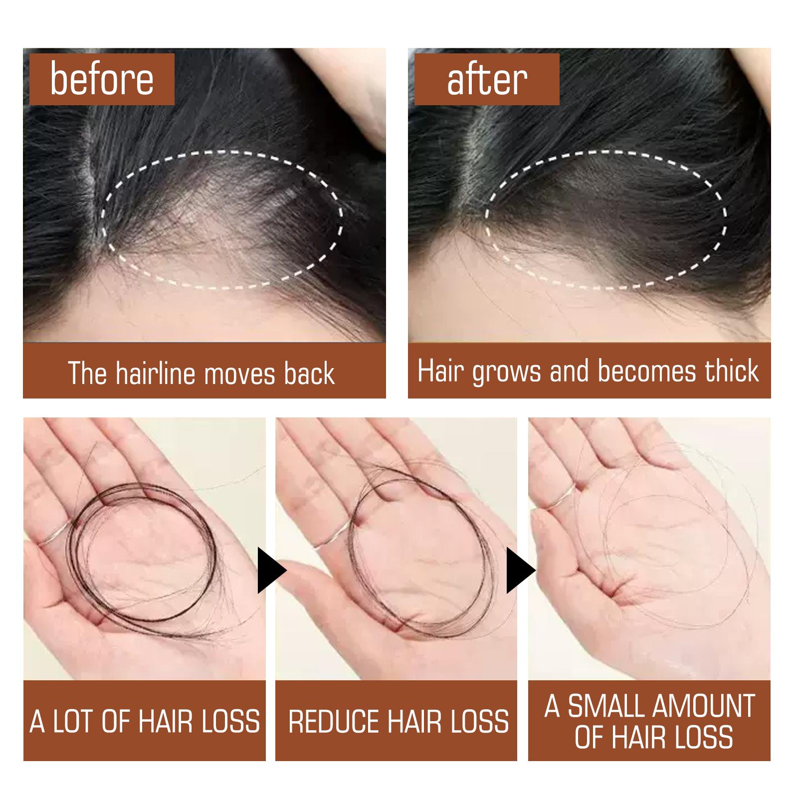 Batana Oil – Fuller, Thicker Hair Care