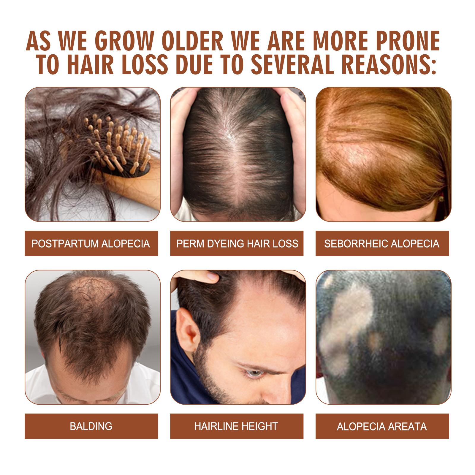 Batana Oil – Fuller, Thicker Hair Care