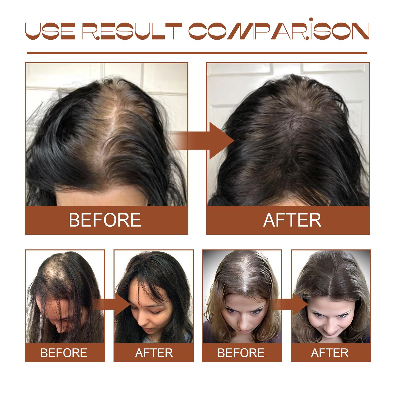 Batana Oil – Fuller, Thicker Hair Care
